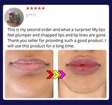 Lip Plumping Balm - Plumps Lips