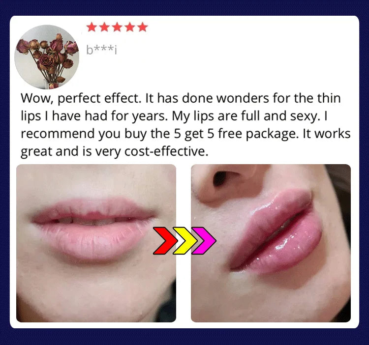 Lip Plumping Balm - Plumps Lips