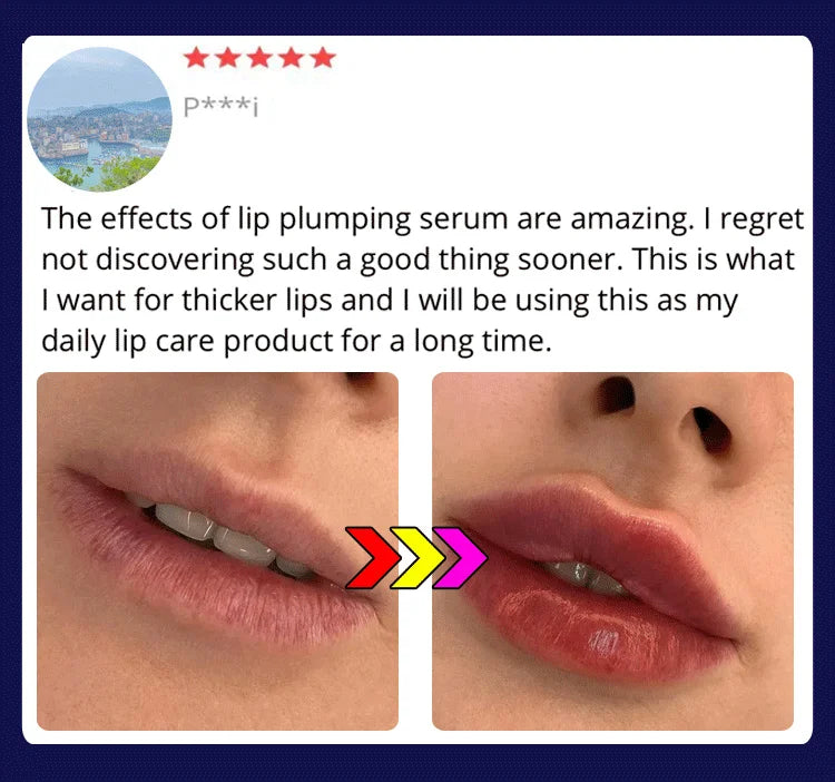 Lip Plumping Balm - Plumps Lips