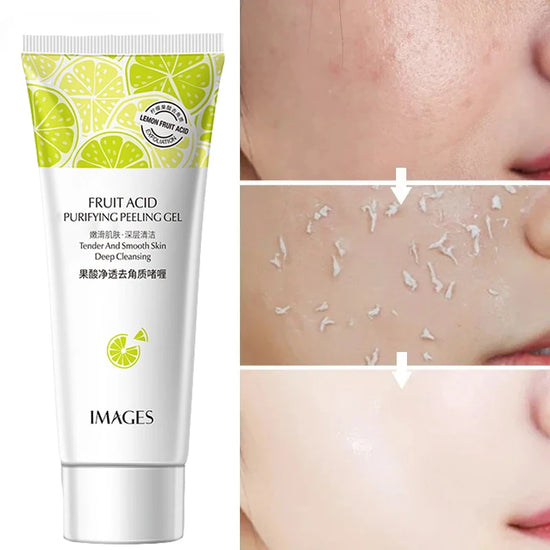 Gel Exfoliant aux Acides de Fruits - Nettoyant & Gommage Visage
